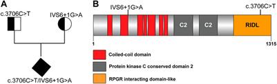 Prenatal phenotype analysis and mutation identification of a fetus with meckel gruber syndrome